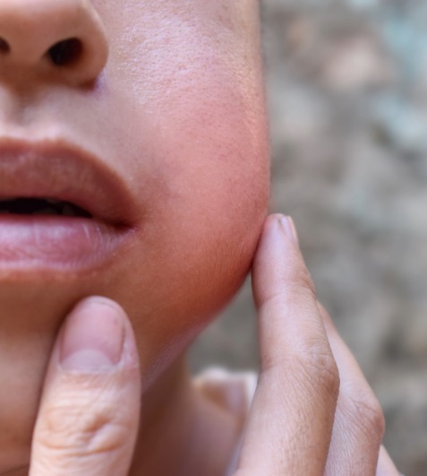 Cyst & Tumours of Mouth & Jaw